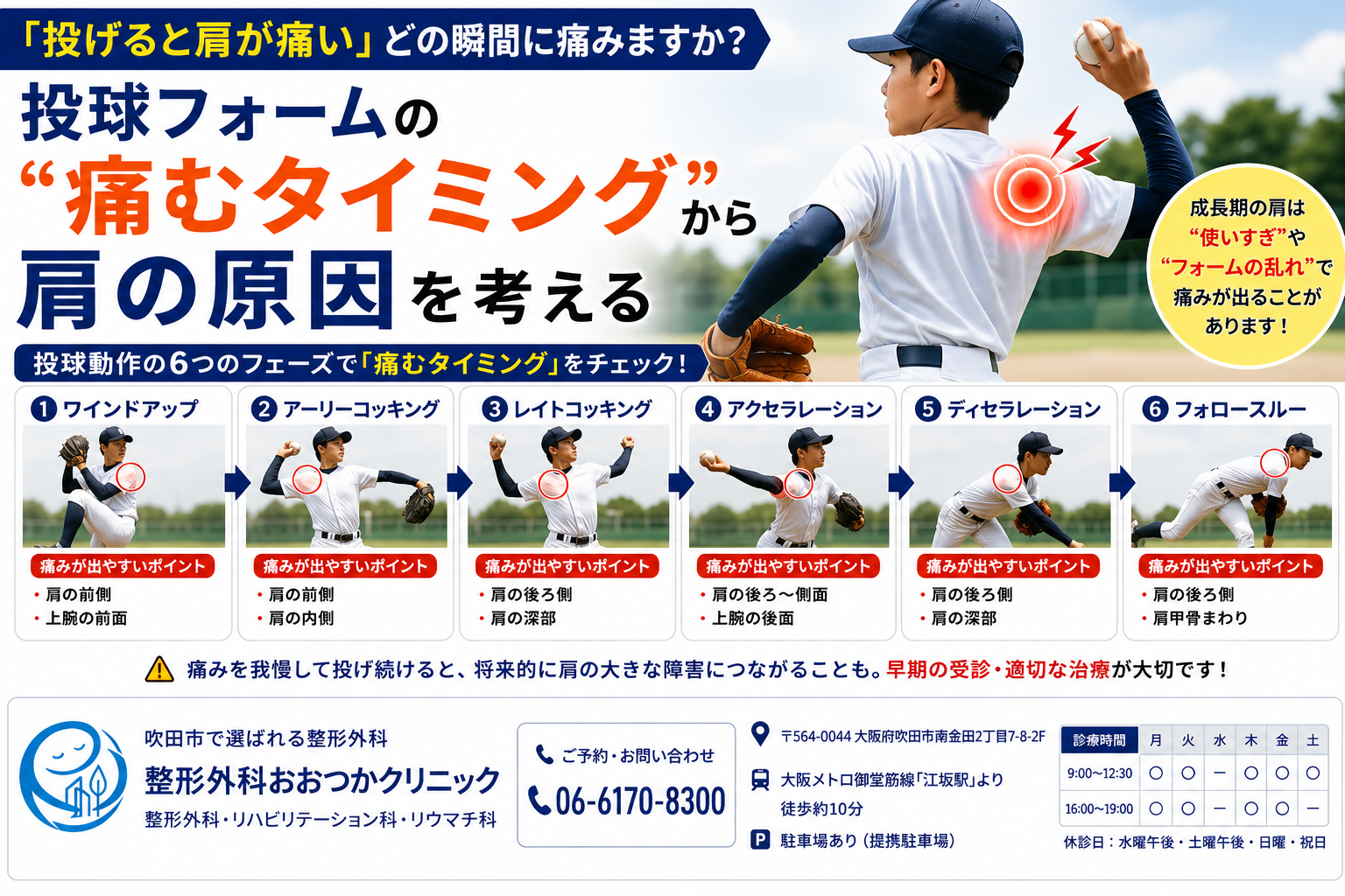 「投げると肩が痛い」どの瞬間に痛みますか?|投球フォームの“痛むタイミング”から肩の原因を考える