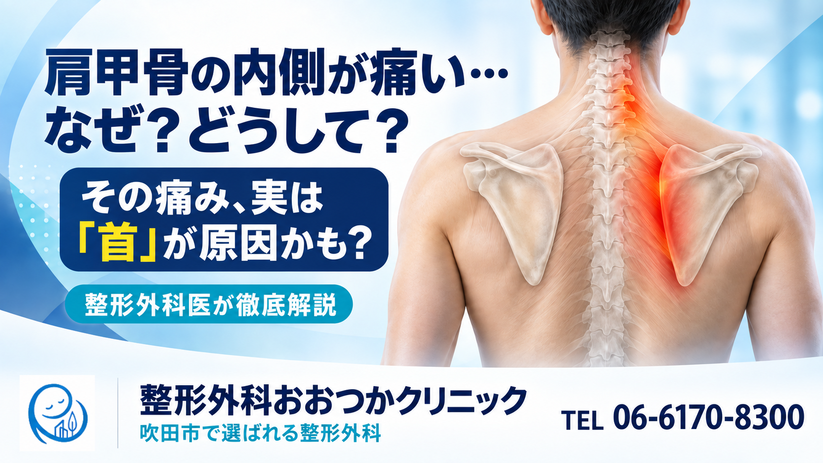肩甲骨の内側が痛い…なぜ？どうして？｜その痛み、実は「首」が原因かも？整形外科医が徹底解説