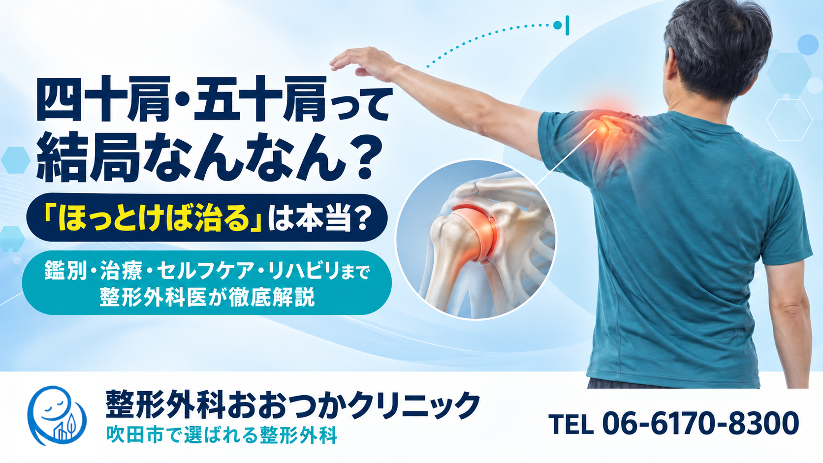 四十肩・五十肩って結局なんなん？｜「ほっとけば治る」は本当？鑑別・治療・セルフケア・リハビリまで整形外科医が徹底解説