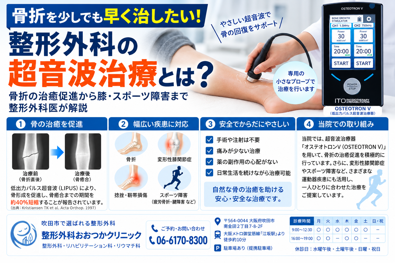 骨折を少しでも早く治したい！整形外科の「超音波治療」とは？｜骨折の治癒促進から膝・スポーツ障害まで整形外科医が解説
